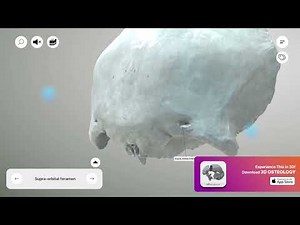 Frontal Bone - Supraorbital foramen