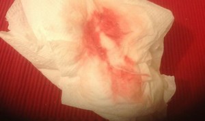 Breakthrough Bleeding (On the Pill) Causes, How Long It Lasts & How to Stop It — Brighter Press