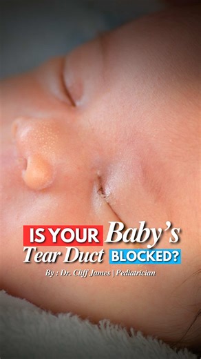 Understanding Blocked Tear Ducts in Babies