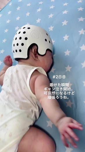 赤ちゃんのためのヘルメット治療2日目の記録