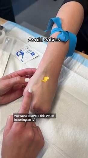 IV Start Tips 👀🩸 #RN #BSN #futurenurse
