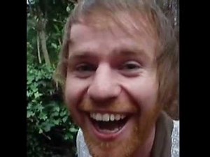 World's biggest forehead