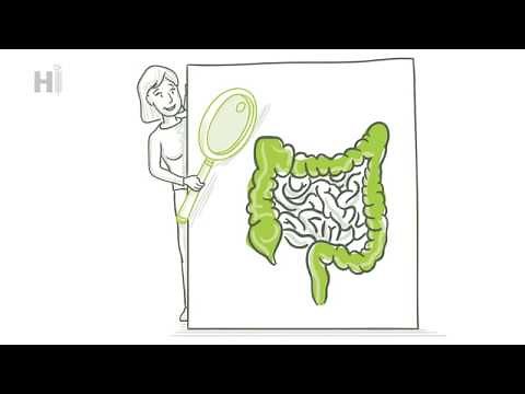 KSSG Koloskopie – Darmspiegelung