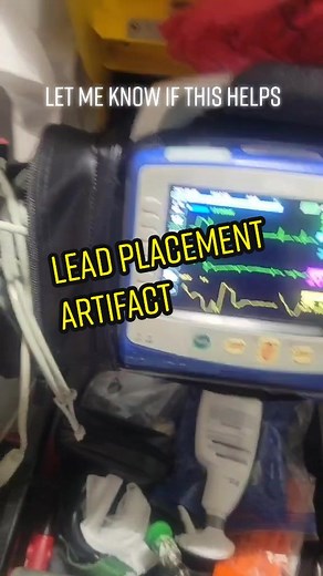 Proper Lead Placement for Artifact Identification in Paramedic Team Leadership