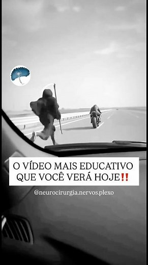 LESÃO DE PLEXO BRAQUIAL - dá pra evitar⁉️