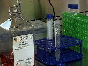 Directed Dopaminergic Neuron Differentiation from Human Pluripotent Stem Cells