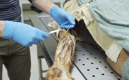 前臂的肌肉解剖musculature and functions