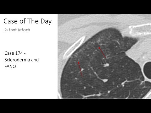 Case of the Day - 174 - Scleroderma and FANO