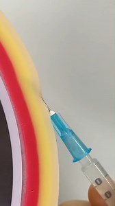 💉 ¿Cómo saber inyectar como experto? No es solo pinchar: es conocer ángulos, profundidad y técnica para evitar dolor o complicaciones. ¡Una habilidad básica que todo médico debe dominar! 🩺 Estudiantes, ¿qué tan seguro te sientes con la aguja? Dímelo en los comentarios y únete a mi taller online para practicarlo a fondo. 🚀 ¡Inscríbete ya! 🔗 #Medicina #Inyecciones #TallerOnline | GPA Academy