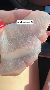 5.6M views · 967 reactions | From visible and clogged pores to a clear nose  Add this nose patch to your routine for clear and healthy pores  30% OFF - https://vueswiss.com/products/hydrocolloid-nose-patches Try today with a 60-day money-back guarantee! 朗 | Vue Swiss | Facebook