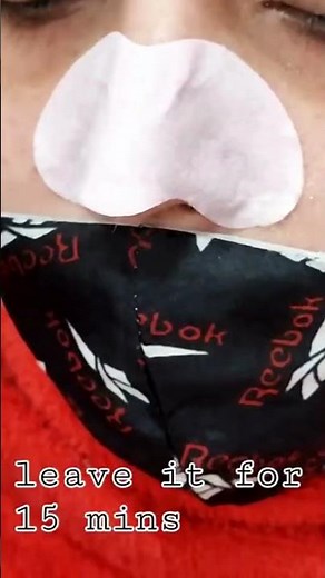 Best Blackhead Remover Strips for Instant Clear Skin