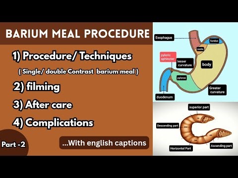 Barium Meal Procedure ll Part-2 ll upper GI series #bariumstudy #barium