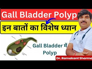 Gall Bladder Polyp | gallbladder polyp treatment ‪@dr.ramakantsharma7‬