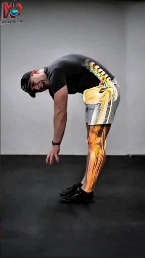 What Is A Herniated Disc? #sciaticarelief #mobility #painrehabb #nervepain #sciaticanerve #shorts