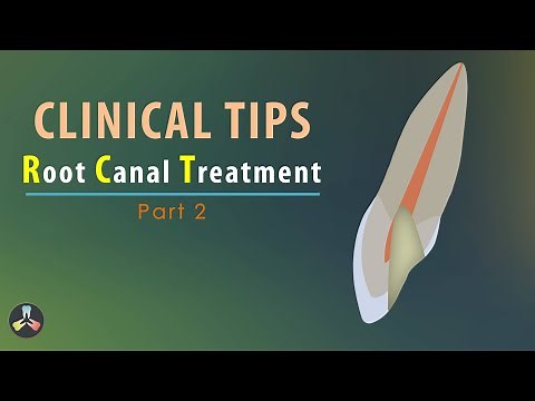 Root Canal Treatment | Clinical tips | Part 2
