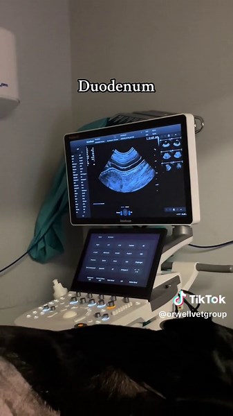 New Ultrasound Machine: Features and Technology Overview