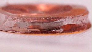 13K views · 147 reactions | A Nature Biomedical Engineering paper describes a miniaturized electromagnetic device that can be used for deep tissue pathology diagnosis. The device was used to accurately locate lesions associated with psoriasis. Read the paper: https://go.nature.com/34WBoQF | Nature Portfolio | Facebook