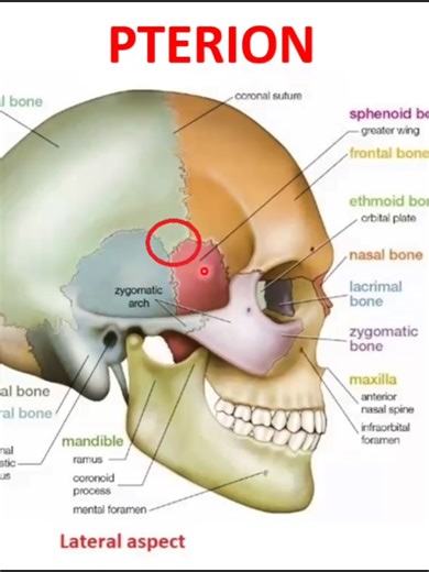 Pterion: Understanding the Junction of Skull Bones