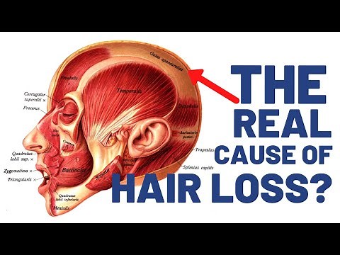 The Galea Aponeurotica's Role In Male-Pattern Baldness and Hair Loss