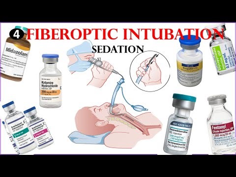 Awake fiberoptic intubation | how to provide sedation