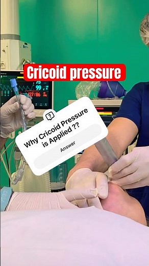 Cricoid Pressure #anesthesia #icu #doctor #medicaleducation #medicalshorts #icunurse
