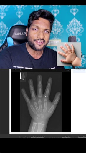 A 3-year-old child's hand bones aren't fully connected yet! FACT