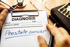 Prostate Cancer - Diagnosis of Prostate Cancer - Urology Austin