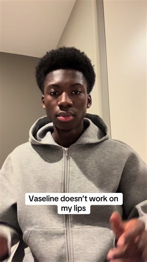 Alternativen zu Vaseline für trockene Lippen