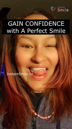 How is my teeth makeover | Instant Smile Veneer | Teeth Veneers | Perfect Smile Veneers