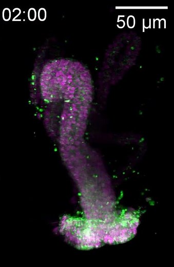 Timelapse of the embryonic fly hindgut