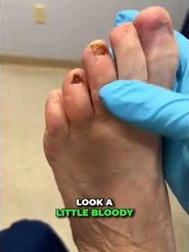 The Vampire Toenails You Didn’t Know