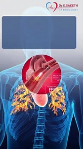 Not Every Blockage Needs a Stent — Here’s How We Know! || Dr Saketh
