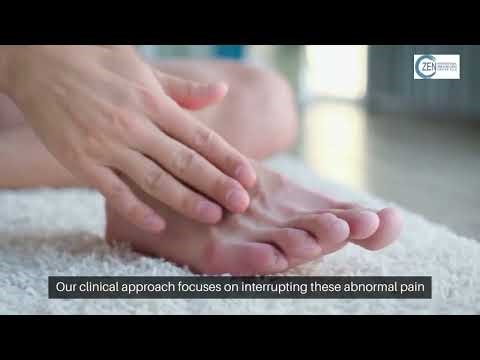 What Causes CRPS in Mansfield, TX? Signs, Causes & Treatment