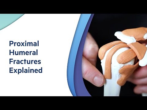 Proximal Humeral Fractures: Explained by Adelaide Orthopaedic Surgeon - Dr Oscar Brumby-Rendell