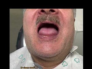 dental full denture fitting procedure