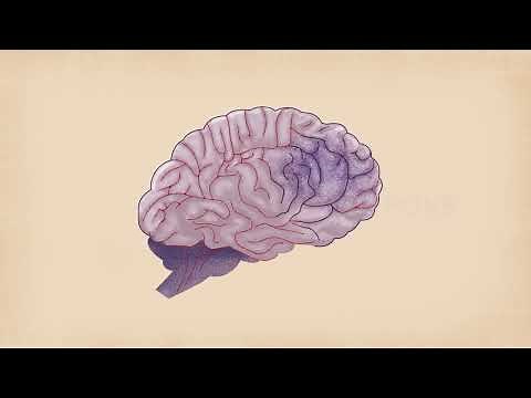 This is the WATCHMAN Implant