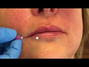 Lip pop using PDO threads