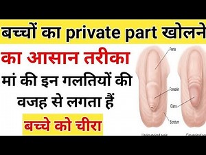 How to open baby private part