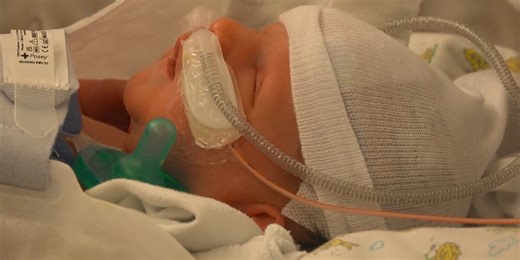 ‘This is an emergency’: Baby survives rare feet-first birth in risky breech delivery