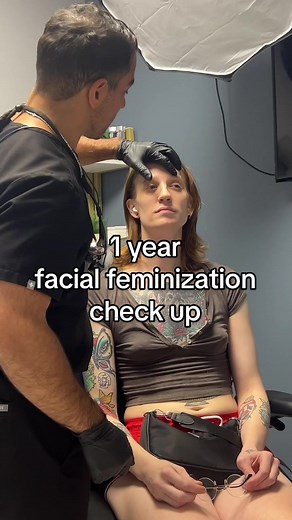 1 Year Post-Op Facial Feminization Check-Up with Jeff Jumaily, M.D.