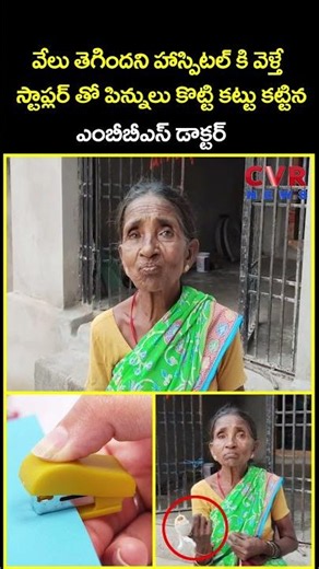 వేలు తెగిందని హాస్పిటల్ కి వెళ్తే స్టాప్లర్ తో పిన్నులు కొట్టి కట్టు కట్టిన...| Viral | CVR News