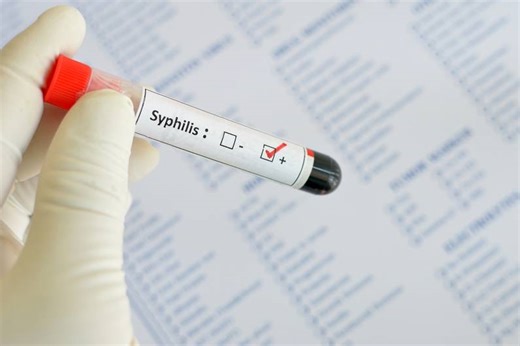 Syphilis: Symptome, Ansteckung und Behandlung