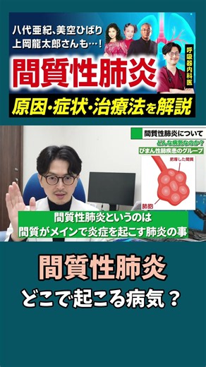 間質性肺炎は肺のどこで起こるのか？【美空ひばりも八代亜紀も】間質性肺炎とはどんな病気？原因から症状、治療法を呼吸器内科医が解説