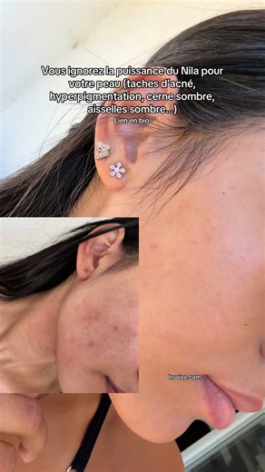 Utilisation de la Poudre de Nila pour une Peau Parfaite