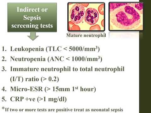 Neonatal Sepsis | Pediatrics