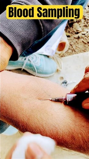 Blood Sample Technique | Blood Collected Procedure #bloodcollection #shorts