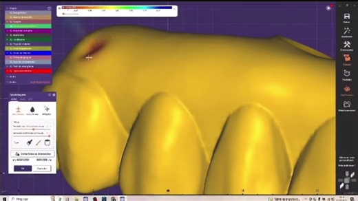 Essential Exocad Tips for Dental Labs