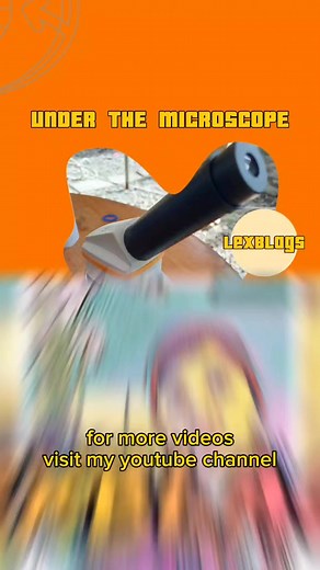 Kuto ng Tao sa Microscope #lexblags#underthemicroscope | Felix Villones