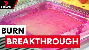 Painful skin grafts for burn victims could soon be a thing of the past after a world-first breakthrough by Melbourne scientists. They have discovered how to grow skin in a lab from human cells and transplants are already a huge success. 📱Download the 7NEWS app: 7news.link/7newsapp #7NEWS | 7NEWS Melbourne