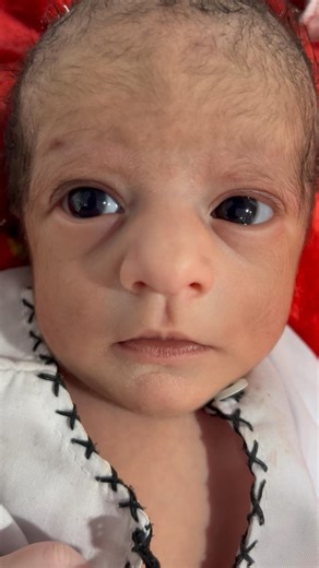 Cute Little Newborn Baby in NICU for Observation 👶🤲❤️ #NICUBaby #NewbornCare🤲🙏❤️